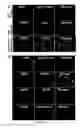 Fig. 09 - Gingiva Derived Stem Cell And Its Application In Immunodulation And Reconstruction