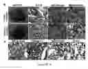 Fig. 10 - Gingiva Derived Stem Cell And Its Application In Immunodulation And Reconstruction
