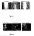 Fig. 03 - SYNTHETIC MACROCYCLIC COMPOUNDS AND METHODS FOR TREATING CANCER