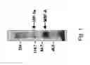 Fig. 02 - Agents capable of downregulating an MSF-A-dependent HIF-1alpha and use thereof in cancer treatment