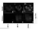 Fig. 35 - Agents capable of downregulating an MSF-A-dependent HIF-1alpha and use thereof in cancer treatment