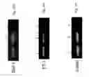Fig. 43 - Agents capable of downregulating an MSF-A-dependent HIF-1alpha and use thereof in cancer treatment