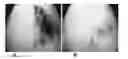 Fig. 01 - METHODS OF INCREASING NEURONAL DIFFERENTIATION USING ANTIBODIES TO LYSOPHOSPHATIDIC ACID