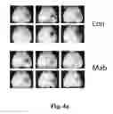 Fig. 05 - METHODS OF INCREASING NEURONAL DIFFERENTIATION USING ANTIBODIES TO LYSOPHOSPHATIDIC ACID