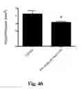 Fig. 06 - METHODS OF INCREASING NEURONAL DIFFERENTIATION USING ANTIBODIES TO LYSOPHOSPHATIDIC ACID