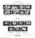 Fig. 23 - Anti-FGF19 antibodies and methods using same
