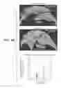 Fig. 24 - Anti-FGF19 antibodies and methods using same