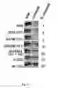 Fig. 03 - APOLIPOPROTEIN L- I VARIANTS AND THEIR USE
