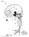 Fig. 12 - AUTISM TREATMENT