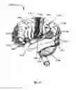 Fig. 23 - AUTISM TREATMENT