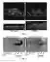 Fig. 04 - COMPOSITIONS AND METHODS FOR THE REMOVAL OF BIOFILMS