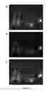 Fig. 06 - COMPOSITIONS AND METHODS FOR THE REMOVAL OF BIOFILMS