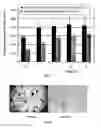 Fig. 07 - NANOSTRUCTURED SILDENAFIL BASE, ITS PHARMACEUTICALLY ACCEPTABLE SALTS AND CO-CRYSTALS, COMPOSITIONS OF THEM, PROCESS FOR THE PREPARATION THEREOF AND PHARMACEUTICAL COMPOSITIONS CONTAINING THEM