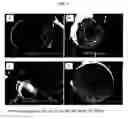 Fig. 04 - MULTI-PHASE MICROPARTICLES AND METHOD OF MANUFACTURING MULTI-PHASE MICROPARTICLES