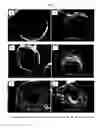 Fig. 07 - MULTI-PHASE MICROPARTICLES AND METHOD OF MANUFACTURING MULTI-PHASE MICROPARTICLES