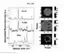 Fig. 10 - MULTI-PHASE MICROPARTICLES AND METHOD OF MANUFACTURING MULTI-PHASE MICROPARTICLES