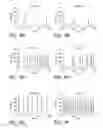 Fig. 09 - Sphingomyelin Liposomes for the Treatment of Hyperactive Bladder Disorders
