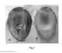 Fig. 08 - Process for producing protein microparticles