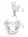 Fig. 02 - ORTHODONTIC TEETH POSITIONING APPLIANCES