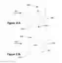 Fig. 12 - Apparatus and methods for detection of tumor cells in blood