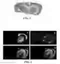 Fig. 03 - Mass spectrometry imaging with substance identification