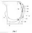 Fig. 03 -  BREAST SUPPORT ARRANGEMENT