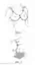 Fig. 02 - Nursing bra