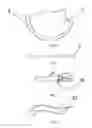 Fig. 02 - Brassiere with wire casing and manufacturing method thereof