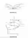 Fig. 10 - Uplift bra