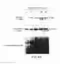 Fig. 45 - Inhibition of apoptosis-specific eIF-5A(eIF-5A1″) with antisense oligonucleotides and siRNA as anti-inflammatory therapeutics