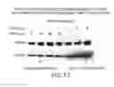 Fig. 89 - Inhibition of apoptosis-specific eIF-5A(eIF-5A1″) with antisense oligonucleotides and siRNA as anti-inflammatory therapeutics