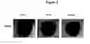Fig. 04 - New Anthraquinone Derivatives