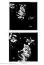 Fig. 03 - Method for producing thin films and the application thereof