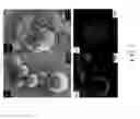 Fig. 08 - Method for Providing a Side-Chain Dendrimer Vesicle