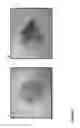 Fig. 02 - Methods of microbial oil extraction and separation
