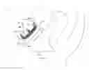 Fig. 01 - Systems, devices, and methods for treating pelvic floor disorders