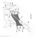 Fig. 45 - Systems, devices, and methods for treating pelvic floor disorders