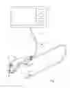 Fig. 02 - IMAGING SYSTEM WITH DISPOSABLE PART
