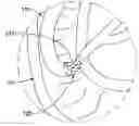 Fig. 01 - Biliary catheter systems including stabilizing members