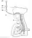 Fig. 01 - Method and apparatus for performing transesophageal cardiovascular procedures