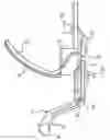 Fig. 01 - Laryngoscope