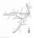 Fig. 02 - Laryngoscope