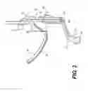 Fig. 03 - Laryngoscope