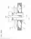 Fig. 115 - METHODS AND DEVICES TO DECREASE TISSUE TRAUMA DURING SURGERY