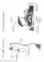 Fig. 46 - METHODS AND DEVICES TO DECREASE TISSUE TRAUMA DURING SURGERY
