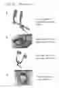 Fig. 84 - METHODS AND DEVICES TO DECREASE TISSUE TRAUMA DURING SURGERY