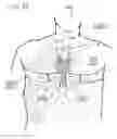 Fig. 98 - METHODS AND DEVICES TO DECREASE TISSUE TRAUMA DURING SURGERY