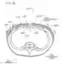 Fig. 99 - METHODS AND DEVICES TO DECREASE TISSUE TRAUMA DURING SURGERY