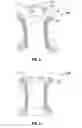 Fig. 08 - Reinforced flexible access assembly
