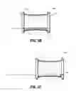 Fig. 07 - ACCESS DEVICE INCLUDING EXPANDABLE DISTAL FLANGE